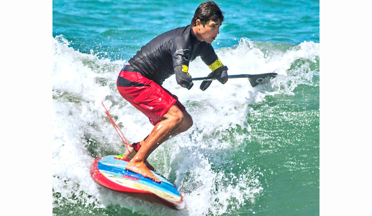 Jonas Letieri is a Brazilian surfer who lost both arms in an electrical accident and has found a way to resume surfing as a stand-up paddler using a specially crafted paddle that he can use with his arm stumps. Here he surfing just north of the San Clemente pier on Monday.ADDITIONAL INFO:01.0713.sc.DOUBLEAMPUTEESURFER.mg - 07/10/2016  -  MANDATORY CREDIT: MICHAEL GOULDING, ORANGE COUNTY REGISTERSpectators at this weekend\'s San Clemente Ocean Festival can expect to be inspired by Jonas Letieri, a Brazilian surfer who lost both arms in an electrical accident and has found a way to resume surfing as a stand-up paddler using specially crafted paddles he attaches to his arm stumps. He can switch from one arm to the other, as needed. He is considered the Bethany Hamilton of Brazil, and his story is inspiring.We can show how he carries the board, how he attaches the paddle and how he switches from one arm to the other while riding a wave, and how he can throw spray doing cutbacks. We will watch him train in the surf at the San Clemente Pier, where the games will be this weekend. He will compete in SUP surfing and SUP paddle racing.