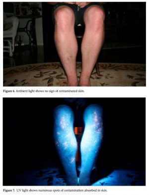 UV Contamination
