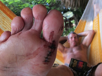 Here are seven tips to help you lower the chances of a surf-related injury.