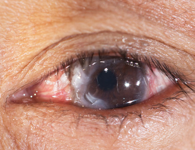 Gross. I want one. Photo: Shutterstock