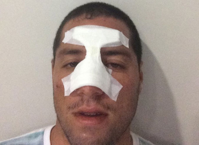 All busted up.