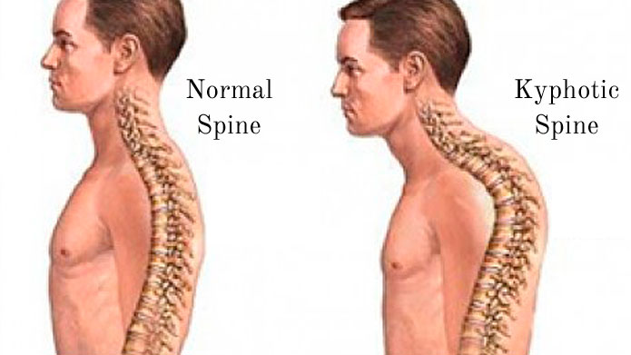 Spines
