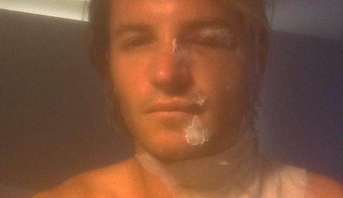 Ouch. Photo: Instagram