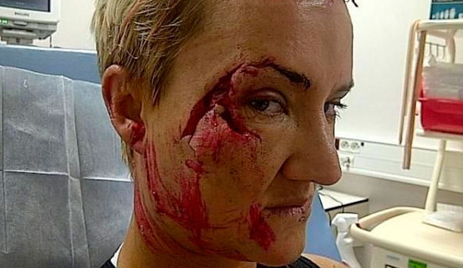 That's what you'd call a Teahupoo kiss. With tongue.
