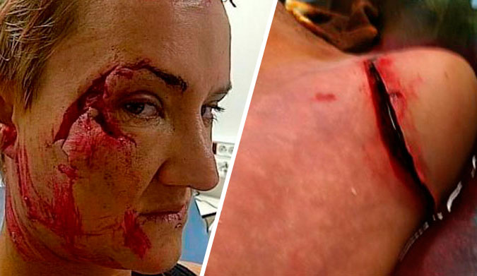 Keala Kennelly and Joel Parkinson's flesh buffets.