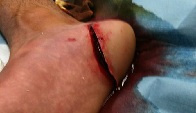 Joel Parkinson's gag inducing injury in 2010.