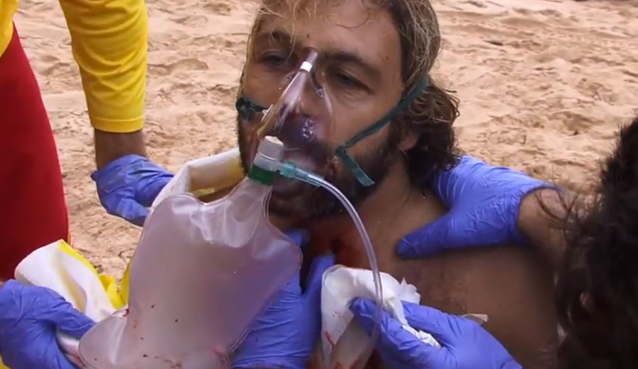 Stabbed in the neck with the surfboard.