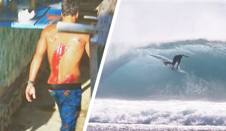 Jeronimo Vargas barreled in Indonesia and reef rash.