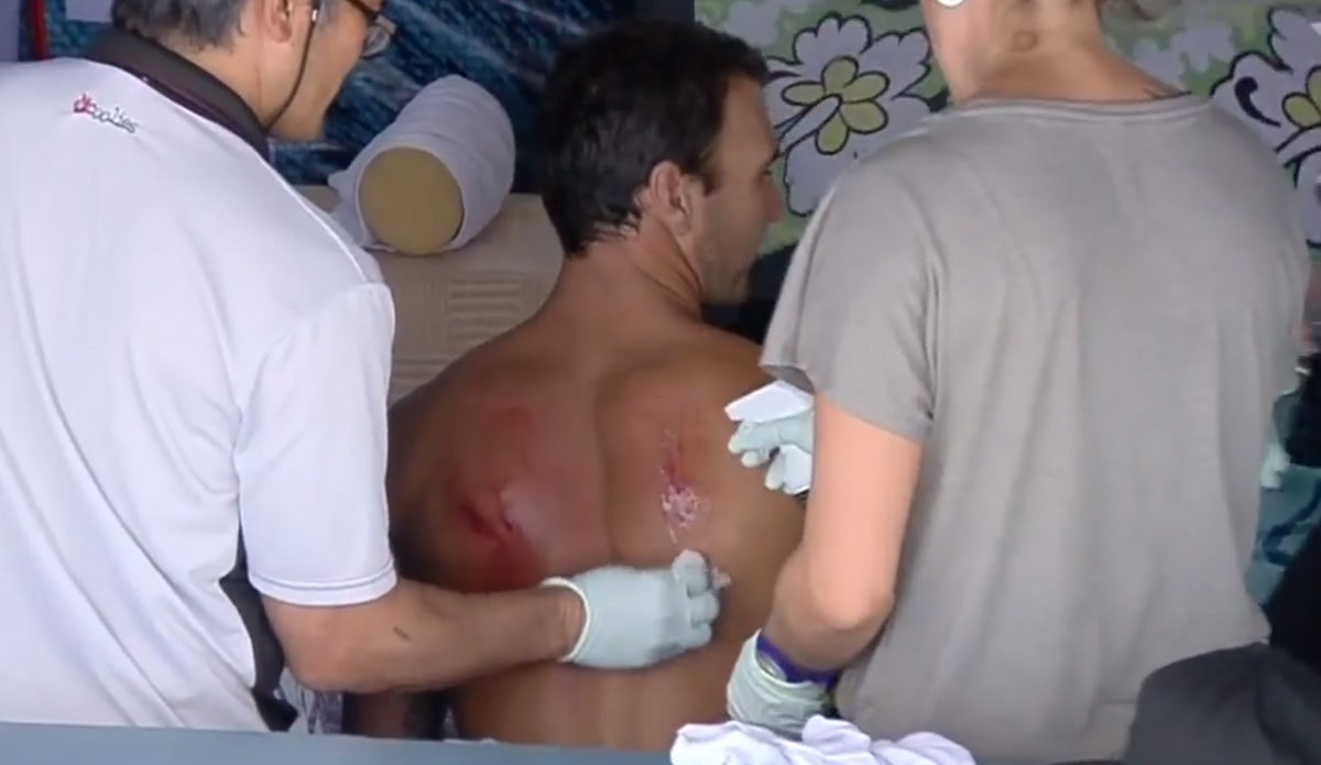 Parko Injured; Out for Sunset