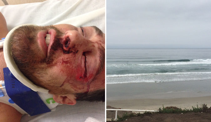When a trip to Mexico goes wrong.