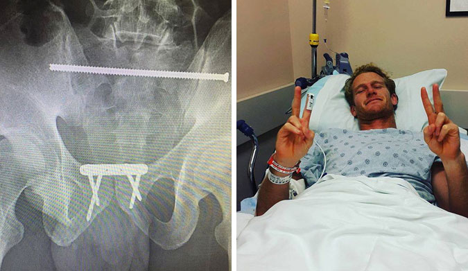 inserted a 17 cm rod, a metal plate, and four screws to hold him together. Photos: Facebook