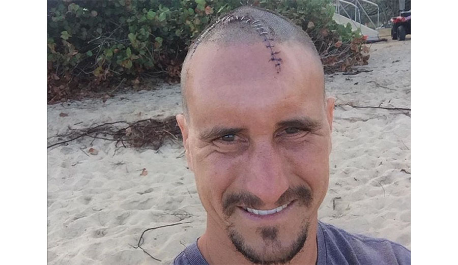 Aaron Gold is a bonafide North Shore charger. It's a dangerous place, though, even on smaller waves. He found that out first hand when he dropped into a Gas Chambers left hander.
