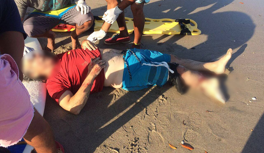 "The victim suffered partial amputation of his right ankle and most of his calf muscle was stripped." Photo: Primero en Noticias