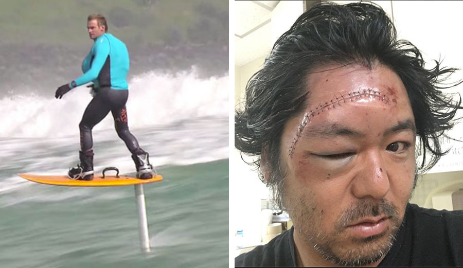 Laird Hamilton, a few years ago on a foil. Recently, a Japanese surfer found out just how dangerous they can be.