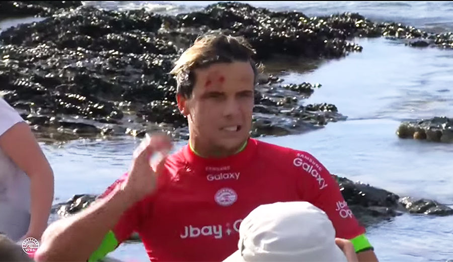 Julian Wilson's a good looking fella... but he almost wasn't!