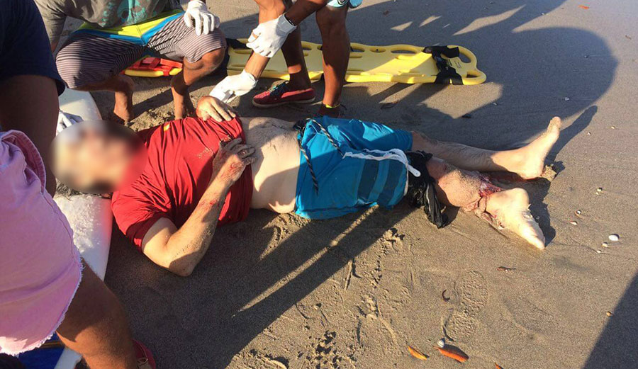 "The victim suffered partial amputation of his right ankle and most of his calf muscle was stripped." Photo: <a href="https://primeroennoticias.com">Primero en Noticias</a>
