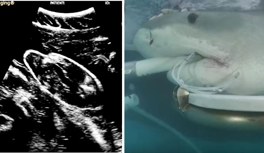 Scientists do some awesome things. Like doing an ultrasound on a pregnant tiger shark.
