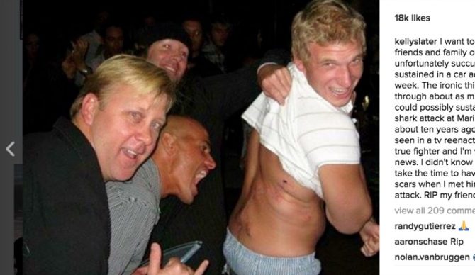 Kelly Slater, demonstrating what a 15-foot great white did to Todd Endris in 2007. Photo: Instagram