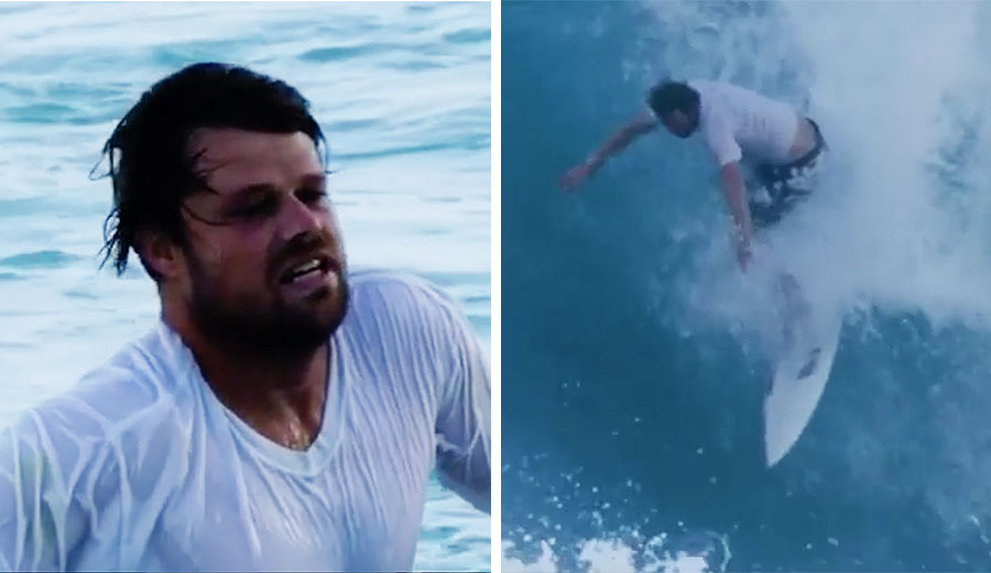 Dane Reynolds cracked a vertebra and bruised his tailbone at Pipeline.