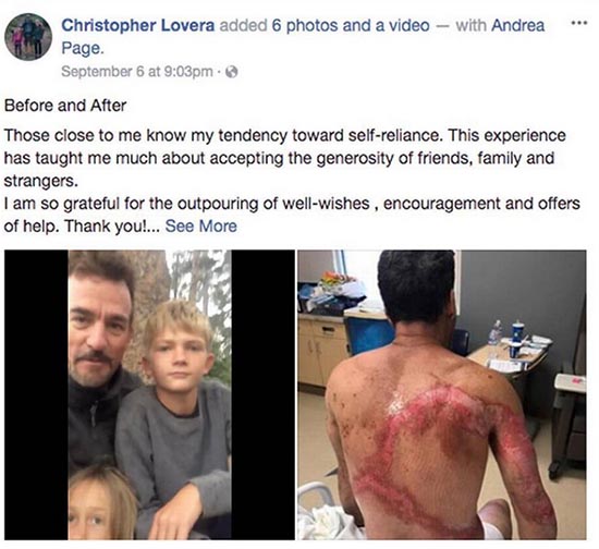 Chris Lovera, Facebook