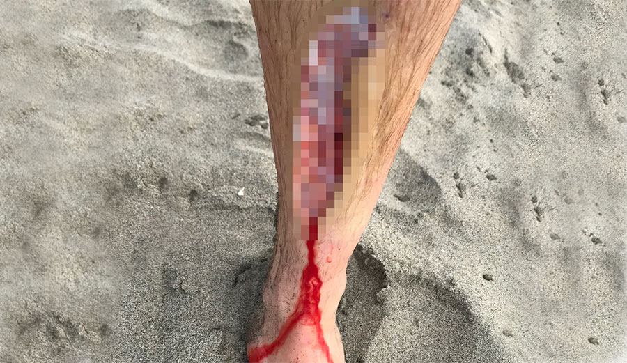 This is a gnarly fin cut. Photo: @tylermccaul