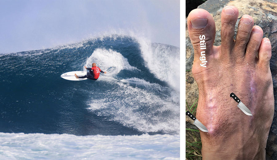 Kelly Slater is out of Margaret River