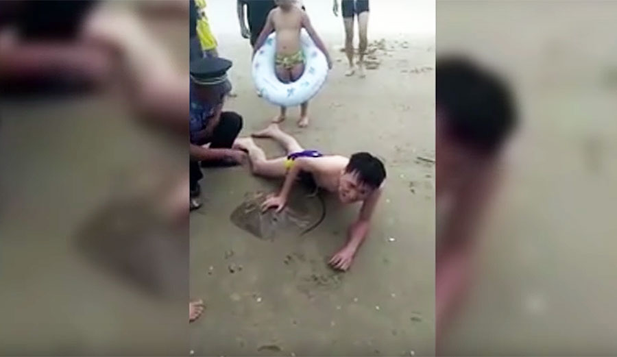 A Chinese swimmer was stung in the groin by a stingray, and it will make you want to stay out of the ocean forever.