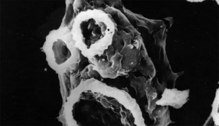 This is Naegleria fowleri, the so-called brain-eating amoeba.