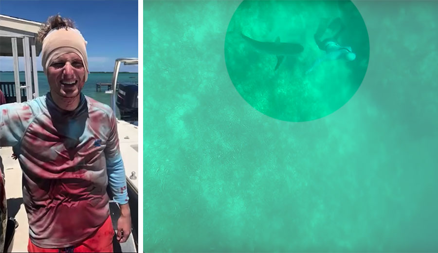 shark attack bahamas