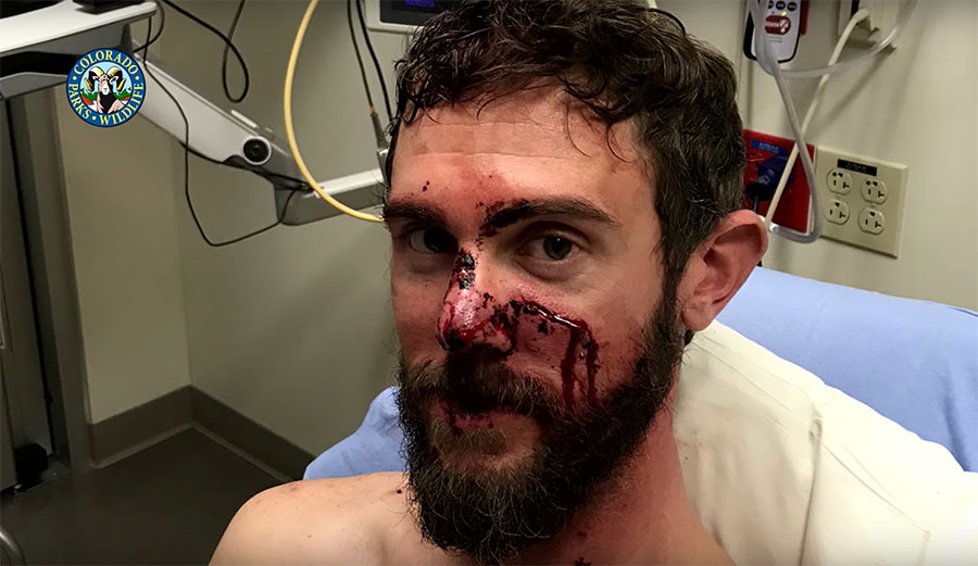 Travis Kauffman mountian lion attack