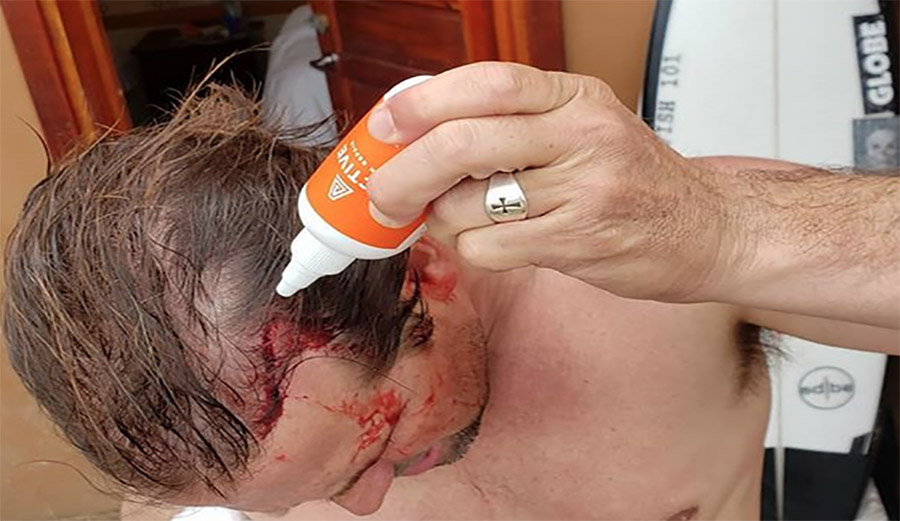 Damien Hobgood blasted by foil in fiji