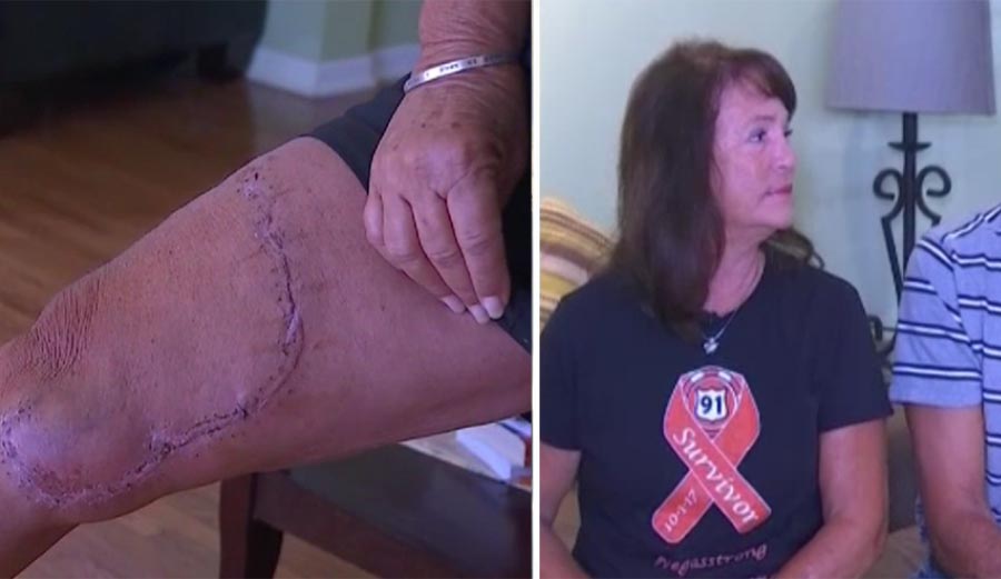 Kimberly Bishop survived the Las Vegas shooting and a shark attack in Hawaii