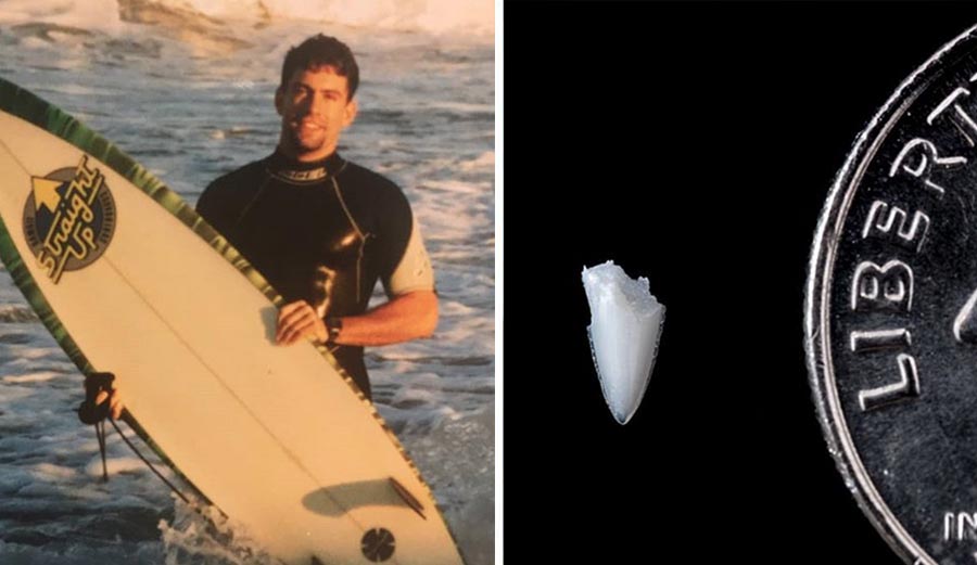 Flagler Beach, 1994: Jeff Weakley was out surfing while attending a college beach party when he felt a sudden, sharp bite to his foot that couldn't have been anything but a shark, he thought. The fish shook his foot repeatedly, leaving him with several deep lacerations. Like most surfers, Weakley valued water time over the tiny chance of another run-in with a shark. Within a couple of weeks, he was back in the ocean with his foot wrapped in a waterproof bandage and covered with booties. Nearly twenty-five years later he noticed a blister forming on his foot. Turns out it was a tooth left from the attack that had finally festered to top of his skin. He removed it and planned to make a pendant from it but changed course when he learned that the Florida Program for Shark Research had identified a shark species through DNA after a bite off the New York coast and decided to have the tooth analyzed. “I was very excited to determine the identity of the shark because I’d always been curious,” Weakley told the Florida Museum of Natural History. “I was also a little bit hesitant to send the tooth in because for a minute I thought they would come back and tell me I’d been bitten by a mackerel or a houndfish – something really humiliating.” But he didn't need to worry. Scientists identified the shark through DNA as a black tip, which Weakley had suspected. When he was bitten at 21 years old, he remembered the water being filled with mullet and had a suspicion black tip were feeding on the baitfish. Today, Weakley, who edits Florida Sportsman magazine, still surfs but tries to avoid areas where baitfish are prevalent. And he has no ill-will towards any species of shark, though. “I’ve been lucky not to have been bitten by a dog, but I would regard that interaction I had with that shark as being no different or more destructive than a dog bite,” he said. “I certainly don’t have a hatred of sharks or any feeling of vindictiveness toward them. They’re part of our natural world.” You can read the full Florida Museum of Natural History report, here.