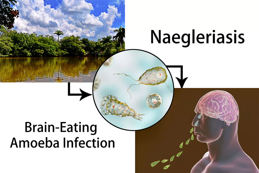 Naegleria fowleri