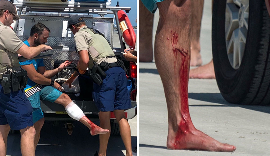 Shark attack victim New Smyrna
