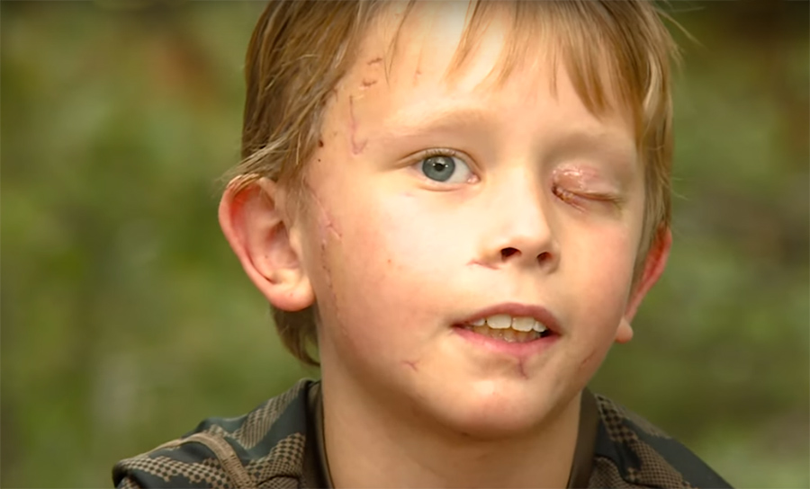 Young Boy and His Family Describe Terrifying Scene of Recent Mountain Lion Attack in Colorado