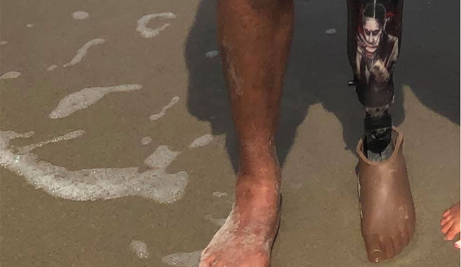 prosthetic leg