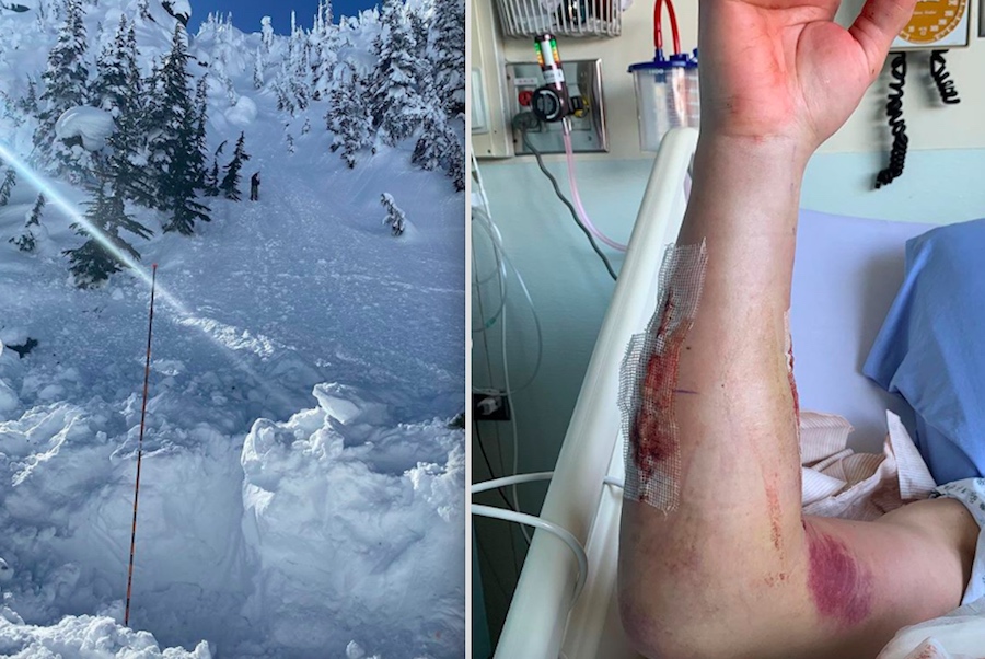 Pro Skier Nick McNutt Caught in Nasty Avalanche, Severely Injured and Lucky to Be Alive