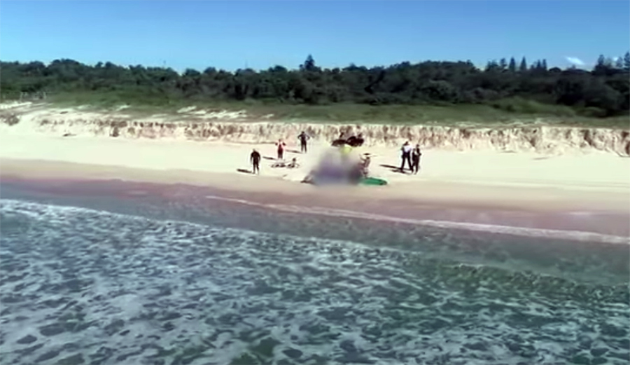 A shark attack victim