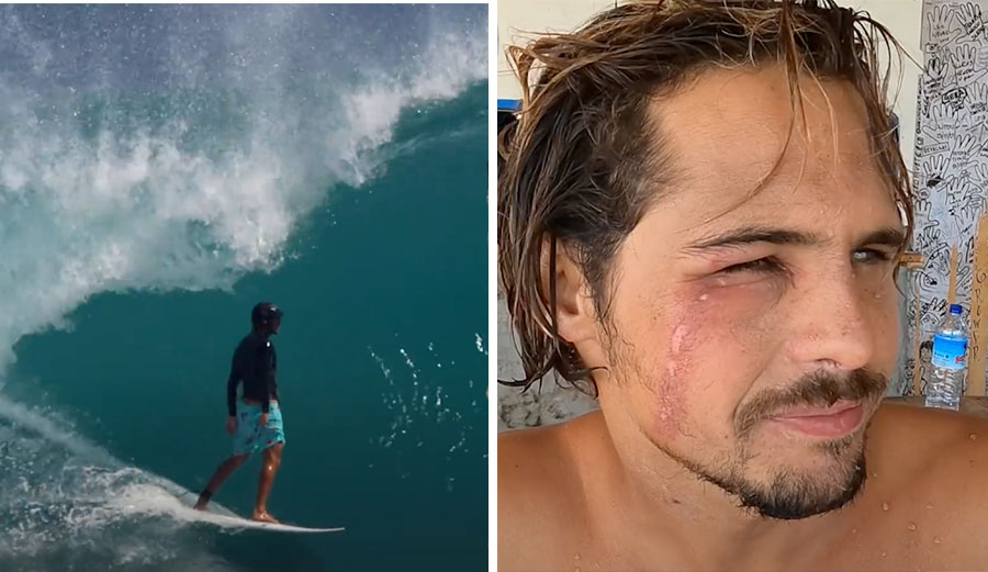 nic von rupp with tomcat bite