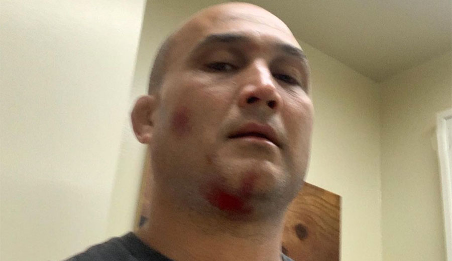 BJ Penn almost died in a wave pool