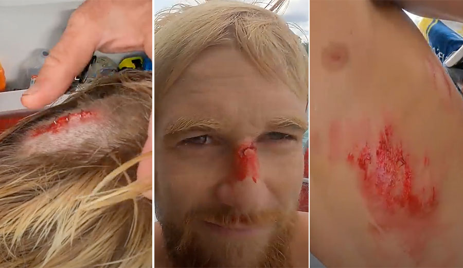 bloody surfers with Nic von Rupp