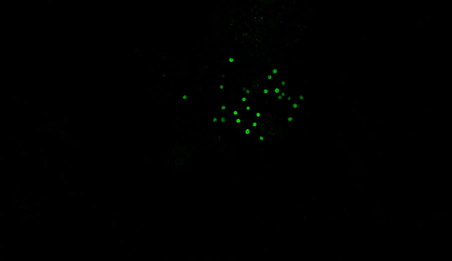 Phytoplankton