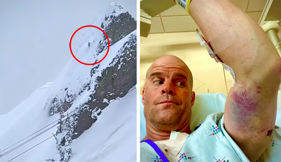 Ski Filmmaker Scott Gaffney Takes Massive Tumble at Palisades; Breaks Scapula, Collapses Lung
