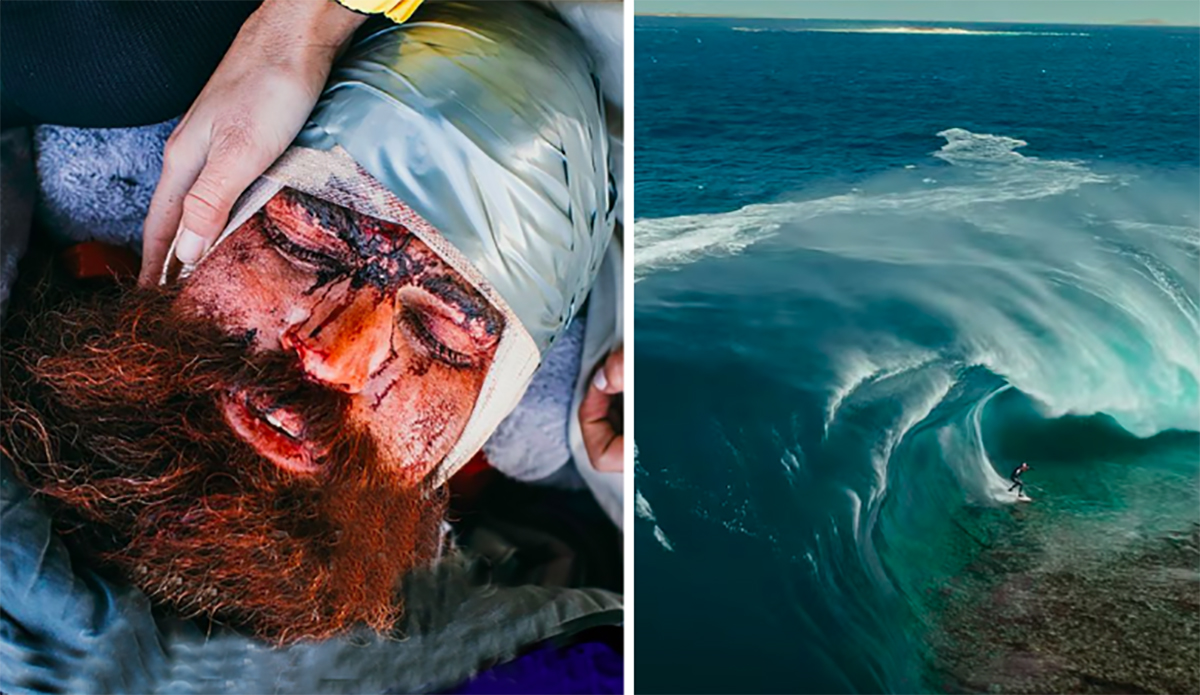 Catching Up With Mutant Slab-Slayer Kerby Brown After His Horrific Surfing Accident
