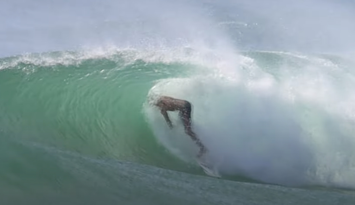 South Straddie surfer gets a board to his face.