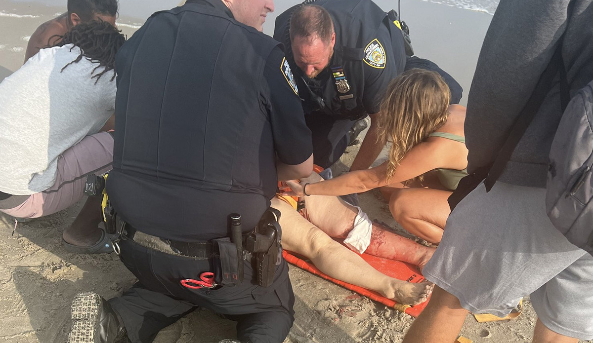 Woman bitten by shark at Rockaway Beach.