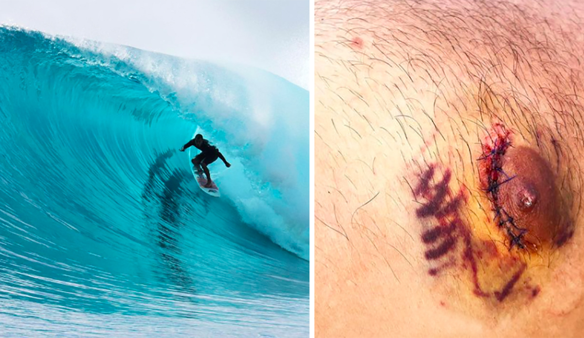 Soli Bailey Almost Left Indonesia with One Nipple Following Accident in Heavy Waves