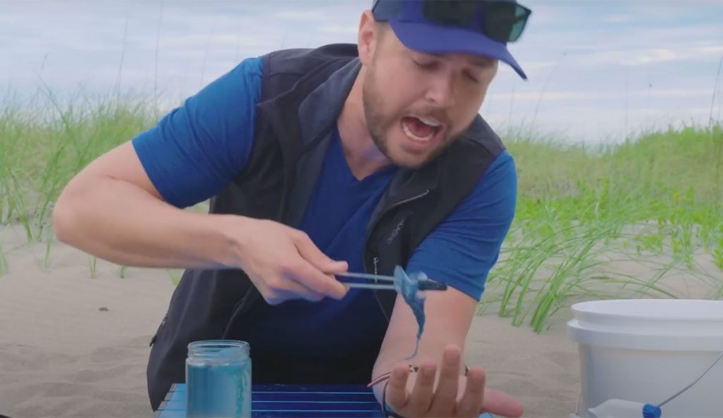 Jellyfish stings
