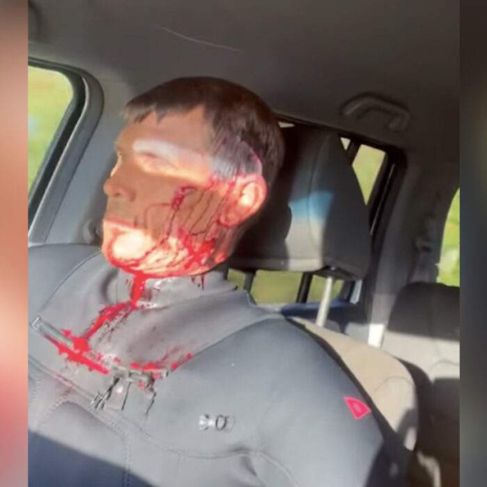 Jamie Mitchell Suffers Gruesome Head Injury Surfing in Hawaii